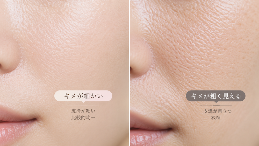 キメが細かい肌とキメが粗く見える肌の違い
