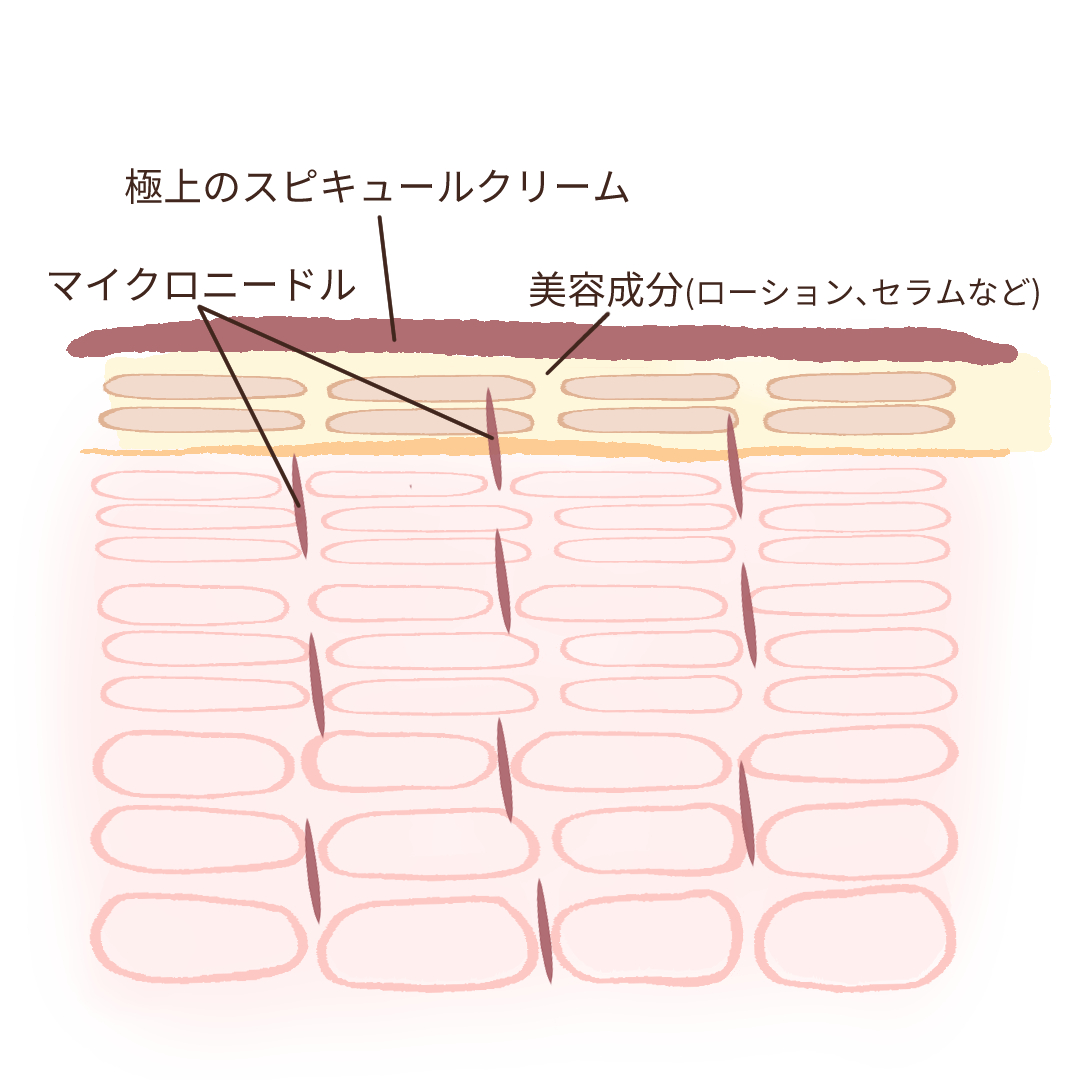 表皮イメージ②
